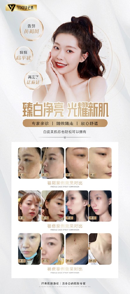 留纤减肥合作的价